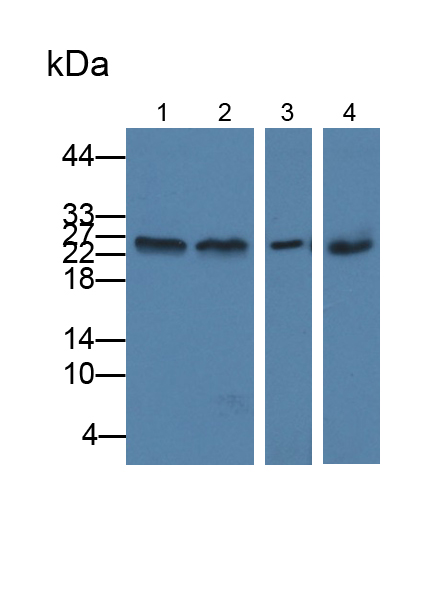 Polyclonal Antibody to Grancalcin (GCA)