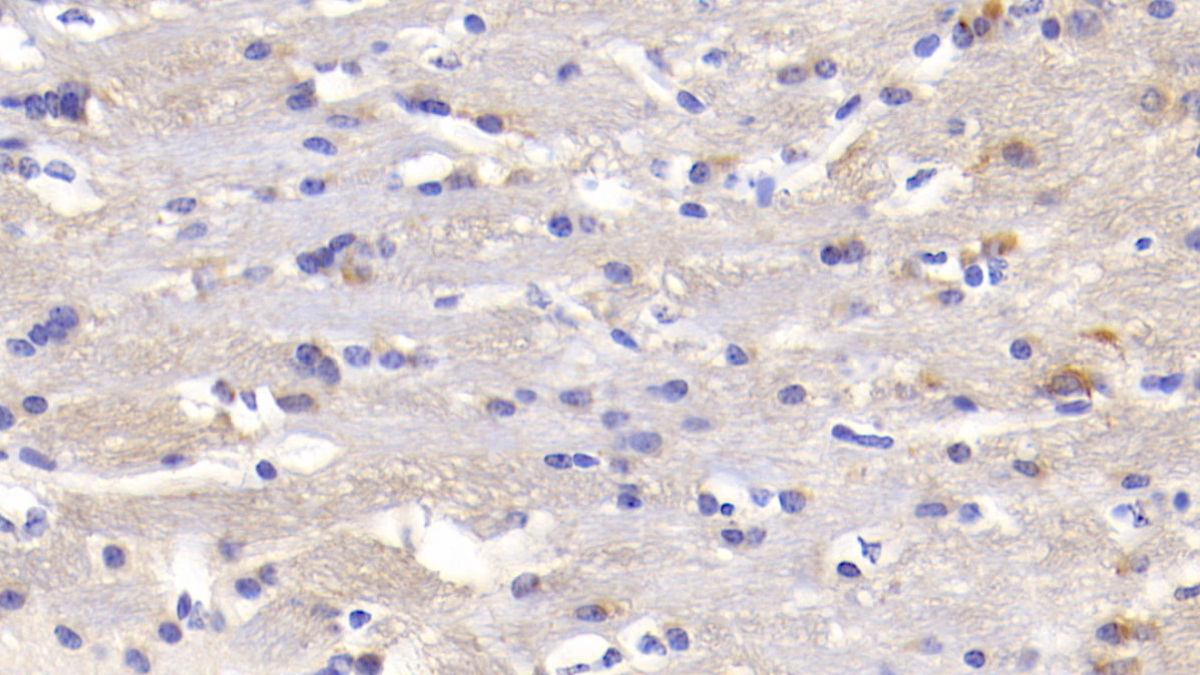 Polyclonal Antibody to Heart And Neural Crest Derivatives Expressed Protein 1 (HAND1)