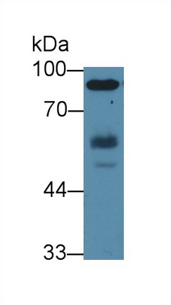 Polyclonal Antibody to Hemopoietic Cell Kinase (HCK)