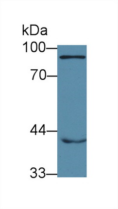 Polyclonal Antibody to Hemopoietic Cell Kinase (HCK)