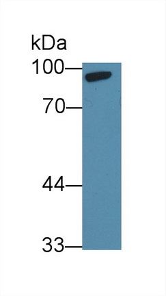 Polyclonal Antibody to Hemopoietic Cell Kinase (HCK)