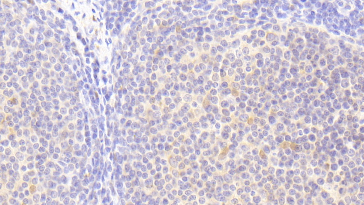 Polyclonal Antibody to Hemopoietic Cell Kinase (HCK)