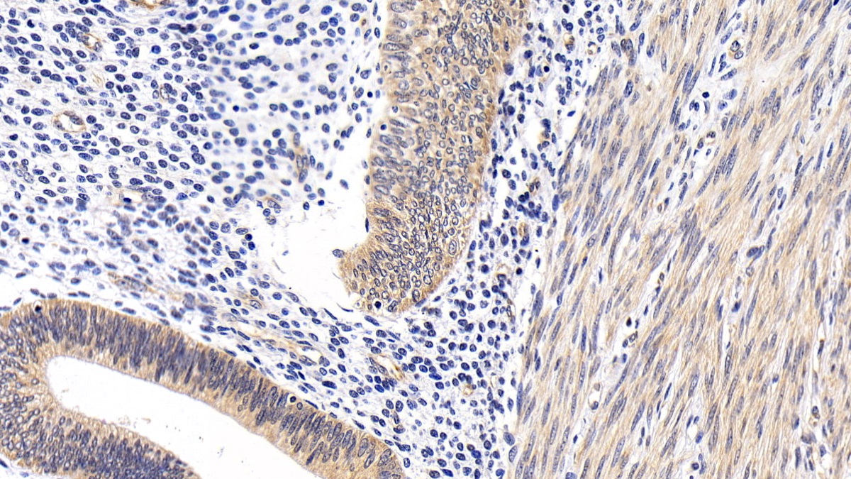 Polyclonal Antibody to Insulin Receptor Substrate 1 (IRS1)