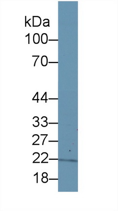 Polyclonal Antibody to Inosine Triphosphatase Pyrophosphatase (ITPA)
