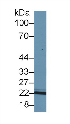 Polyclonal Antibody to Inosine Triphosphatase Pyrophosphatase (ITPA)