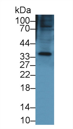 Polyclonal Antibody to Keratocan (KERA)