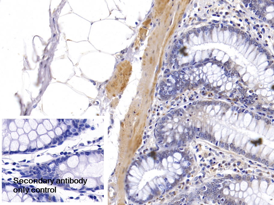 Polyclonal Antibody to Karyopherin Alpha 3 (KPNa3)