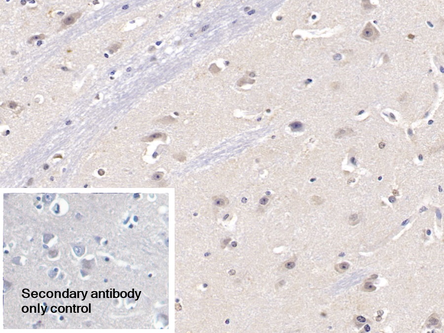 Polyclonal Antibody to Karyopherin Alpha 3 (KPNa3)