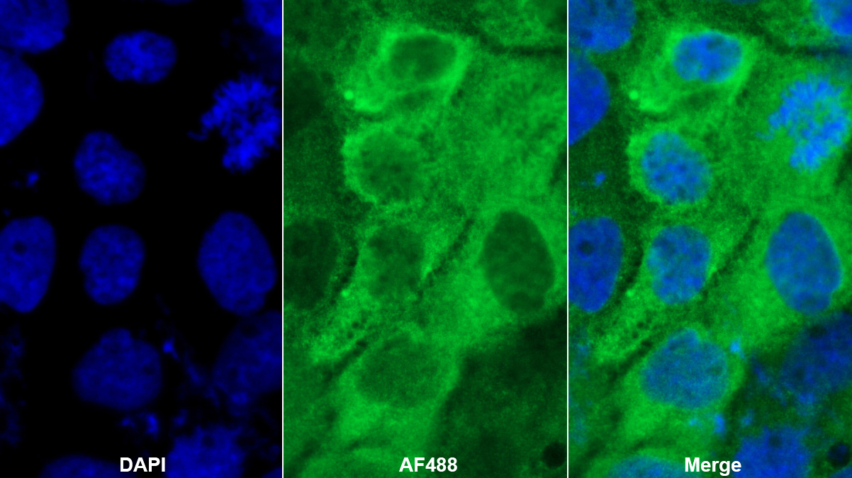 Polyclonal Antibody to L-Plastin (LCP1)