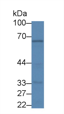 Polyclonal Antibody to Leucine Rich Repeats And Death Domain Containing Protein (LRDD)