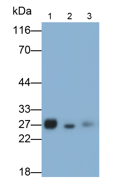 Polyclonal Antibody to Uroplakin 1A (UPK1A)