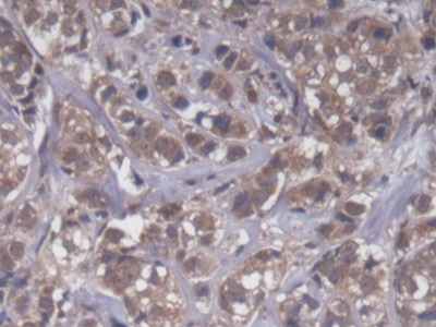 Polyclonal Antibody to Ubiquinol Cytochrome C Reductase Binding Protein (UQCRB)