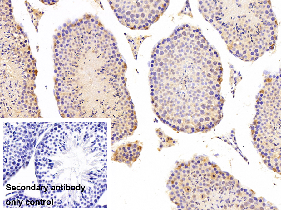 Polyclonal Antibody to Vaccinia Related Kinase 1 (VRK1)