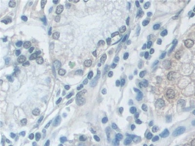 Polyclonal Antibody to Valosin Containing Protein (VCP)