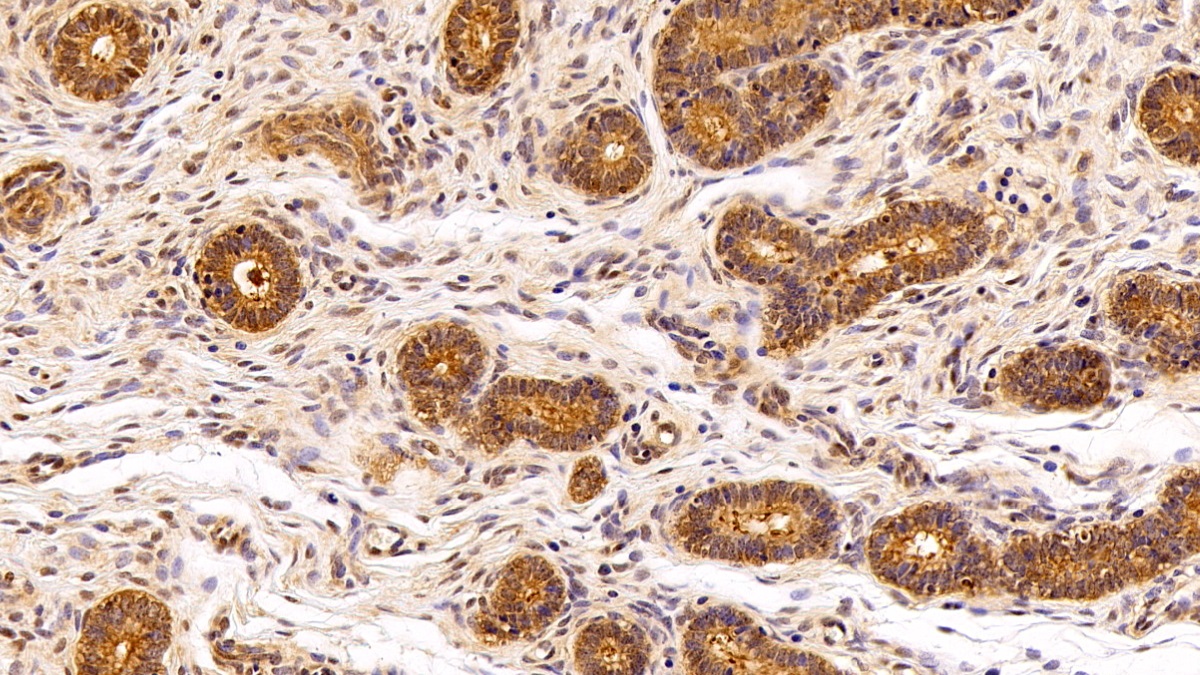 Polyclonal Antibody to Valosin Containing Protein (VCP)