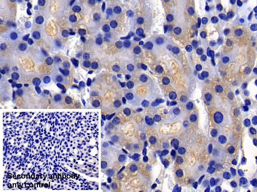 Polyclonal Antibody to X-linked Inhibitor Of Apoptosis Protein (XIAP)