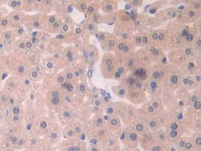 Polyclonal Antibody to Xanthine Dehydrogenase (XDH)