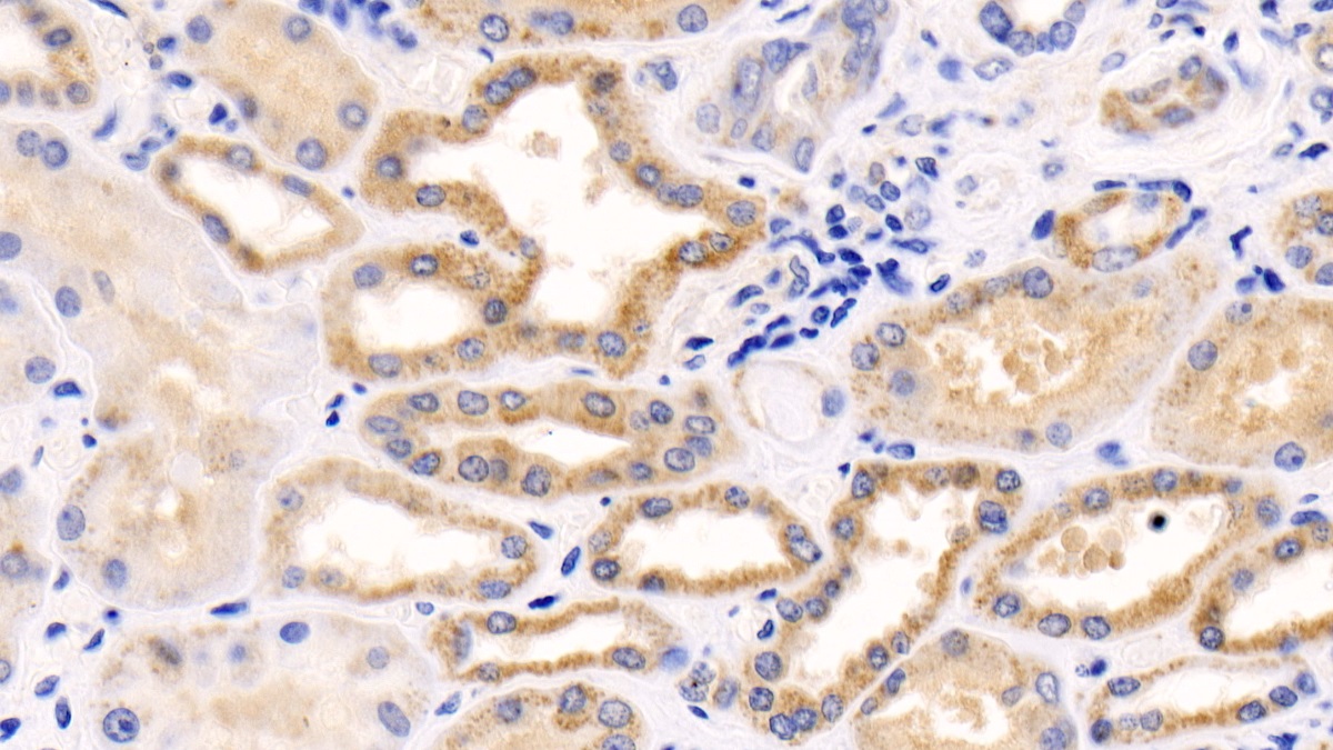 Polyclonal Antibody to Induced Myeloid Leukemia Cell Differentiation Protein Mcl-1 (MCL1)