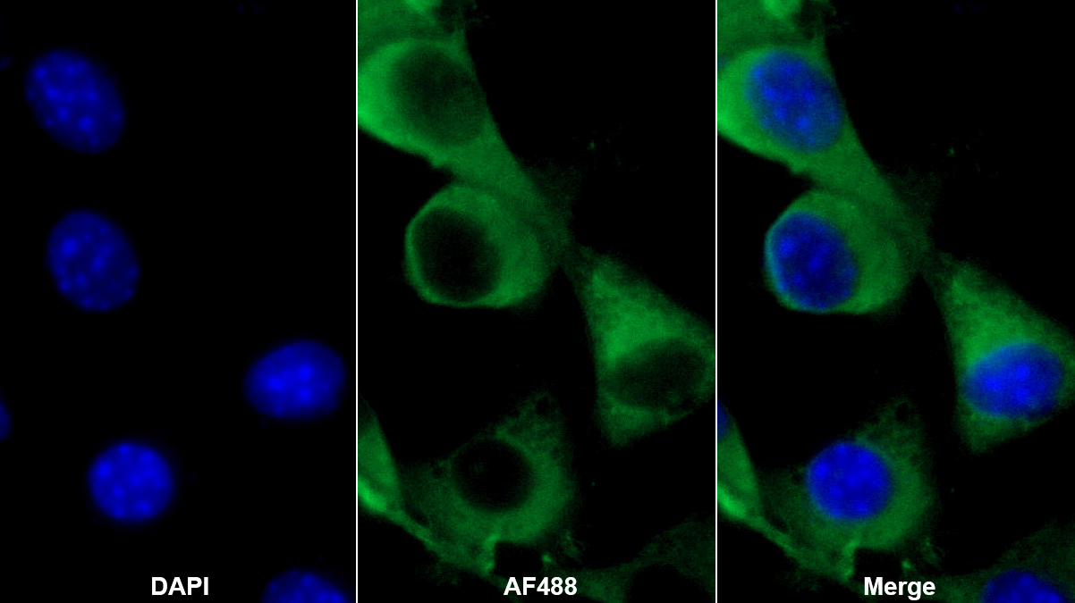 Polyclonal Antibody to Moesin (MSN)