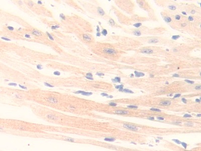 Polyclonal Antibody to Monoamine Oxidase B (MAOB)