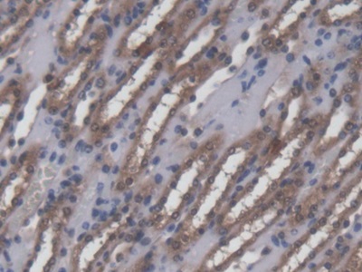 Polyclonal Antibody to Ninein (NIN)