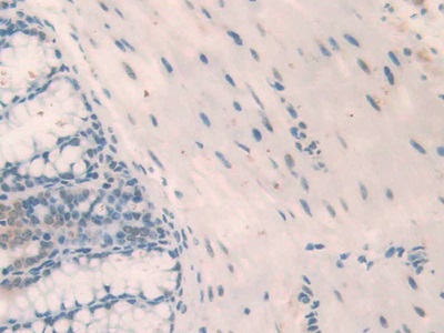 Polyclonal Antibody to Nucleophosmin 1 (NPM1)