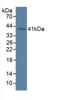 Polyclonal Antibody to 2',5'-Oligoadenylate Synthetase 1 (OAS1)