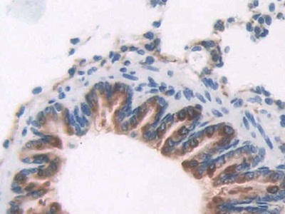 Polyclonal Antibody to 2',5'-Oligoadenylate Synthetase 1 (OAS1)