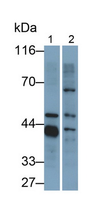 Polyclonal Antibody to Oxoguanine Glycosylase 1 (OGG1)