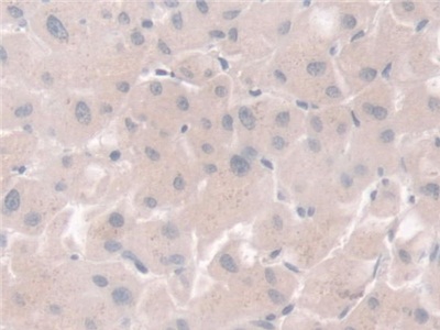 Polyclonal Antibody to Phosphoglucomutase 1 (PGM1)