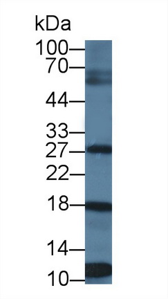 Polyclonal Antibody to Pituitary Tumor Transforming 1 (PTTG1)