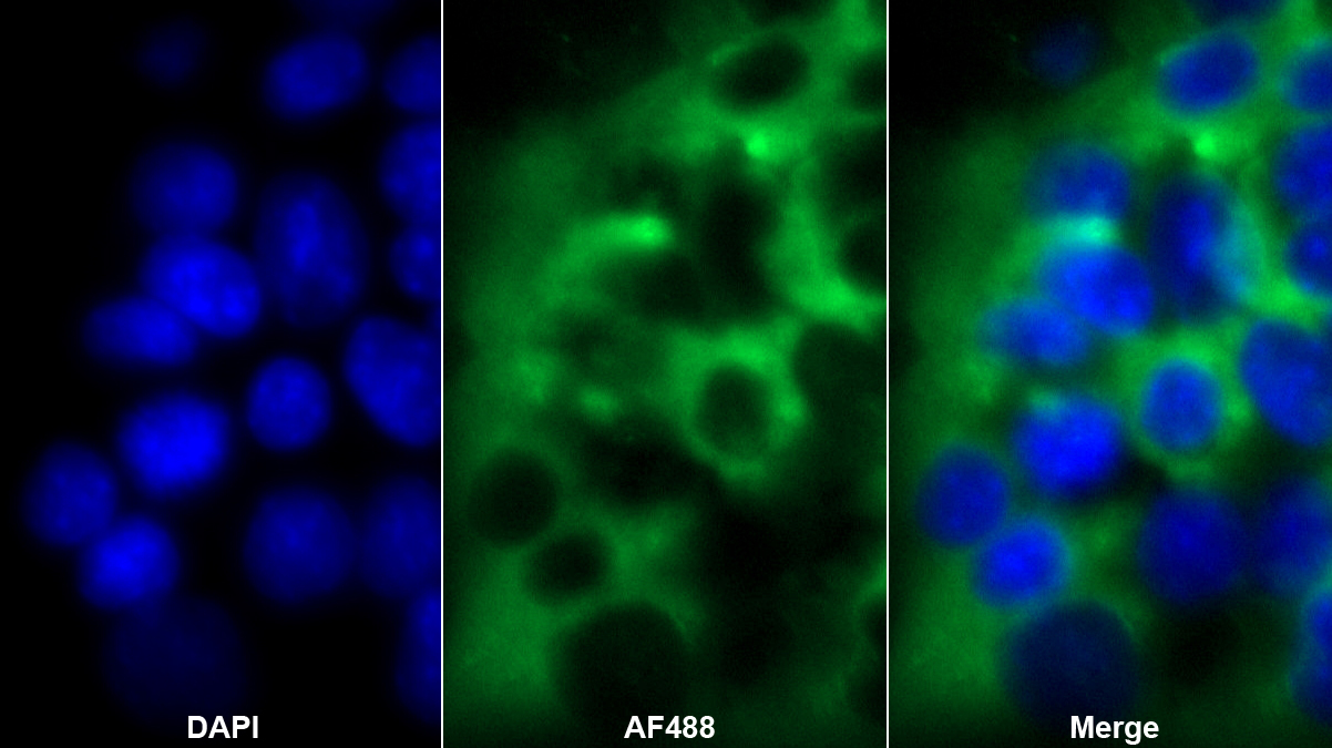 Polyclonal Antibody to Pituitary Tumor Transforming 1 (PTTG1)