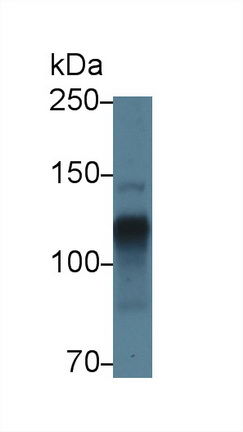 Polyclonal Antibody to Heparan Sulfate Proteoglycan 2 (HSPG2)