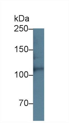 Polyclonal Antibody to Heparan Sulfate Proteoglycan 2 (HSPG2)