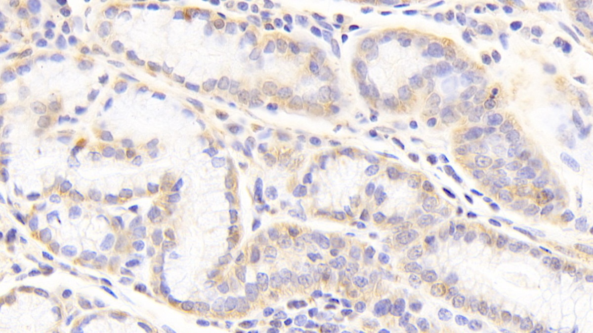 Polyclonal Antibody to Heparan Sulfate Proteoglycan 2 (HSPG2)