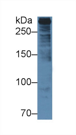 Polyclonal Antibody to Plectin (PLEC)