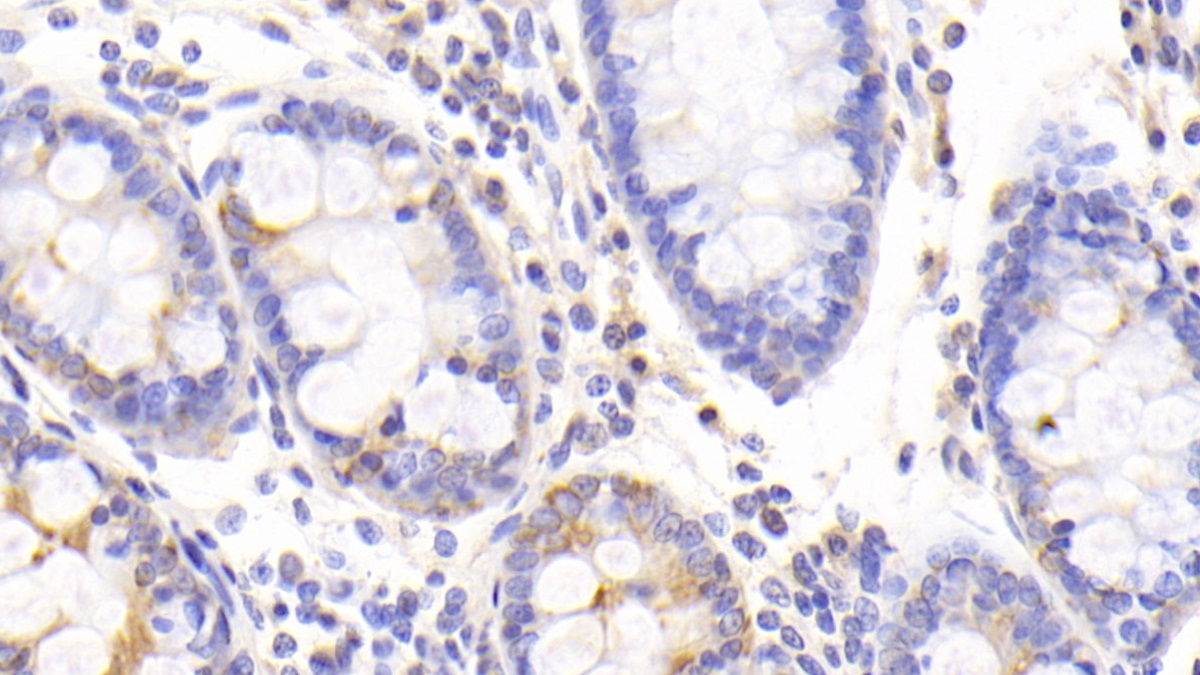 Polyclonal Antibody to Proline Dehydrogenase, Mitochondrial (PRODH)