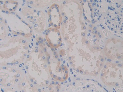Polyclonal Antibody to Ribophorin I (RPN1)