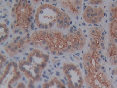 Polyclonal Antibody to Reelin (RELN)