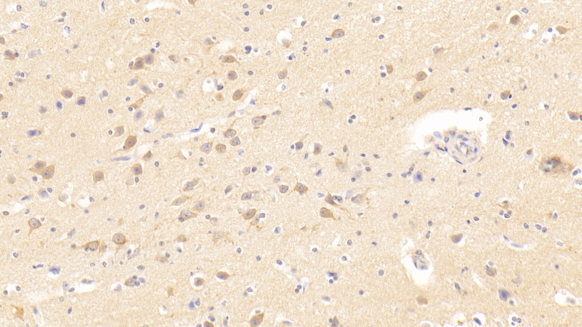 Polyclonal Antibody to Transmembrane Protease, Serine 2 (TMPRSS2)