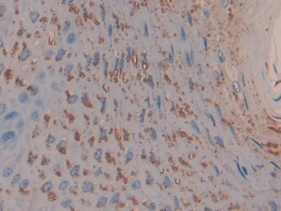 Polyclonal Antibody to Toll Interacting Protein (TOLLIP)