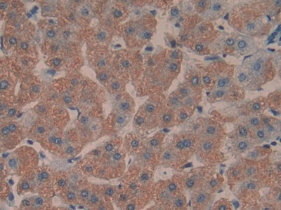 Polyclonal Antibody to Toll Interacting Protein (TOLLIP)