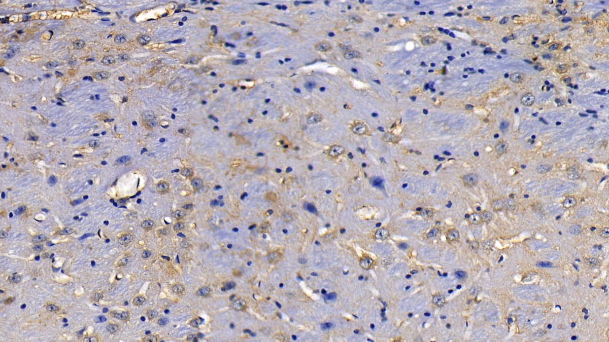 Polyclonal Antibody to Toll Interacting Protein (TOLLIP)