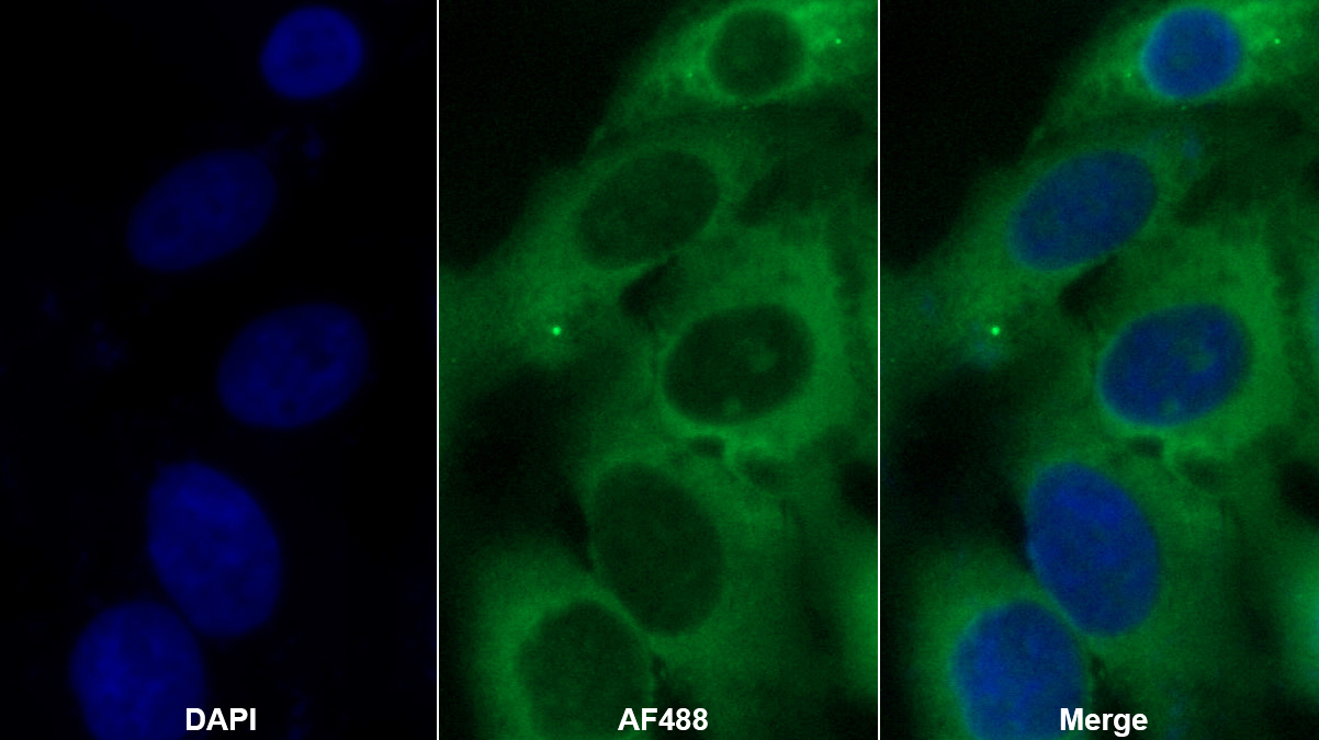 Polyclonal Antibody to Spermine Synthase (SMS)