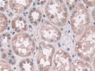 Polyclonal Antibody to Aminoadipate Semialdehyde Synthase (AASS)