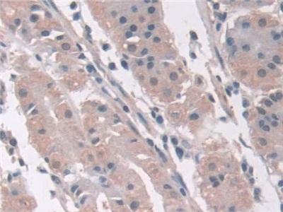 Polyclonal Antibody to Aminoadipate Semialdehyde Synthase (AASS)
