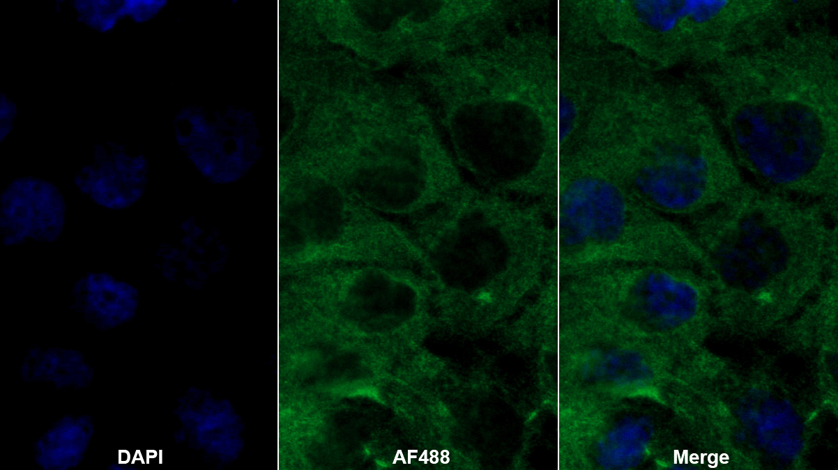 Polyclonal Antibody to Sperm Associated Antigen 1 (SPAG1)