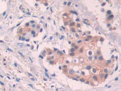 Polyclonal Antibody to Stanniocalcin 1 (STC1)