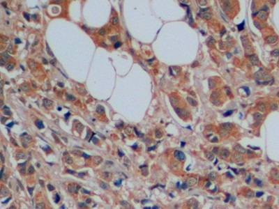 Polyclonal Antibody to Serotonin Transporter (SERT)