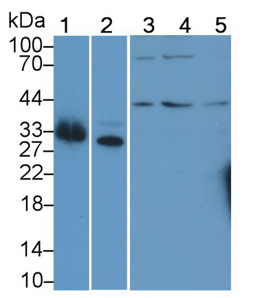 Polyclonal Antibody to Deoxyhypusine Synthase (DHPS)